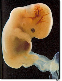 The Unborn